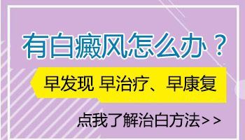 白癜风的症状早期
